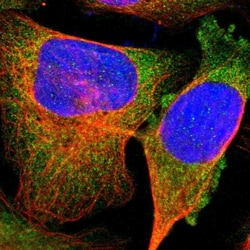 AK2 Antibody, Novus Biologicals:Antibodies:Primary Antibodies